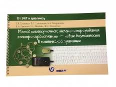 Метод многосуточного телемониторирования электрокардиограммы