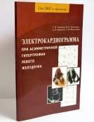 Электрокардиограмма при асимметричной гипертрофии левого желудочка